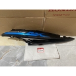 Bộ ốp sườn trái *B189*